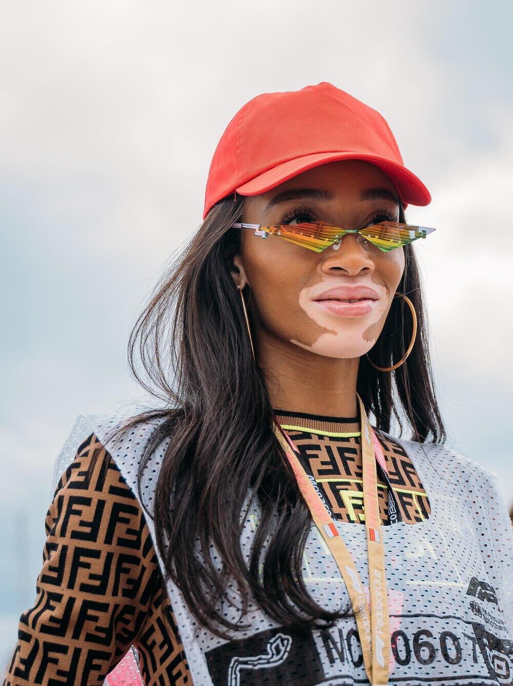 Winnie Harlow
